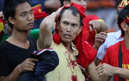 Đêm kinh hoàng: CĐV Malaysia đánh CĐV Việt Nam đổ máu ở AFF Cup 2014