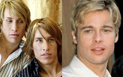 Muốn có ngoại hình như Brad Pitt để kiếm bạn gái, hai anh em sinh đôi chi mạnh 500 triệu đi phẫu thuật thẩm mỹ