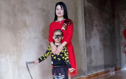 Cái Tết trọn vẹn đầu tiên của cậu bé 6 tuổi có khuôn mặt tựa "người rừng" tại Yên Bái