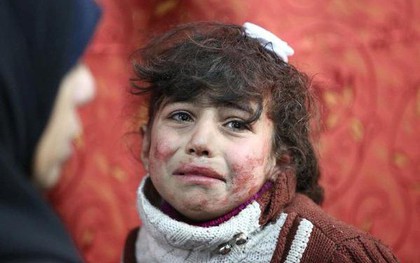 Thảm cảnh của những đứa trẻ tại "thánh địa" chết chóc Syria: Nỗi đau của các em vẫn chưa có hồi kết