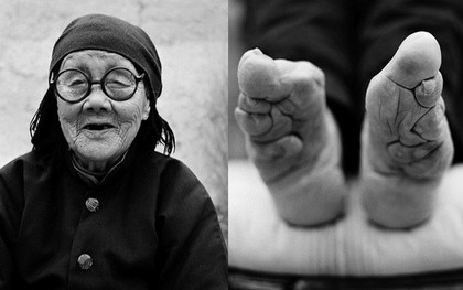 Những đôi chân gót sen cuối cùng tại Trung Quốc: Khi sắc đẹp là nỗi đau suốt đời của người phụ nữ