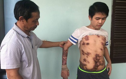 Cậu bé 16 tuổi sống sót sau vụ cháy xưởng bánh kẹo khiến 8 người tử vong ở Hà Nội bây giờ ra sao
