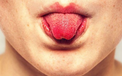Sự thật về cái lưỡi của chúng ta mà rất nhiều người đang nhầm tưởng