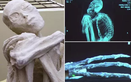 Tranh luận quanh xác ướp kỳ dị gần 6,500 năm tuổi: Thi thể sinh vật ngoài hành tinh hay người cổ đại?