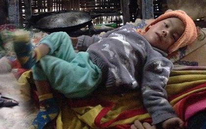 Bố mất sớm, mẹ bỏ đi, cháu bé bại não "sống trên lưng" bà nội