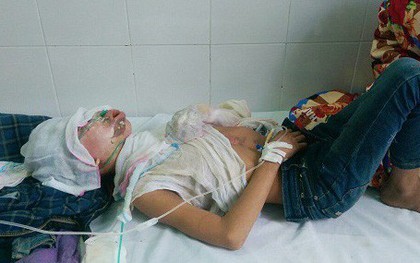Tưới xăng thiêu sống con, cháu ruột vì nhuộm tóc đỏ