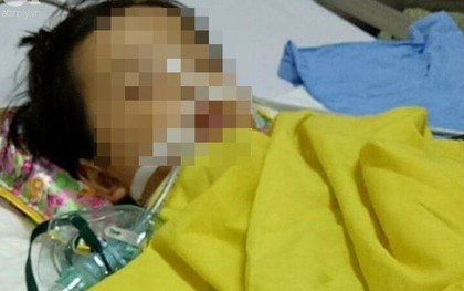 Quảng Ninh: Bé gái 20 tháng tuổi bị rạn hộp sọ, hôn mê sâu, liệt nửa người sau khi đến trường mầm non 3 ngày
