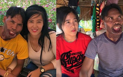 Cuộc sống hạnh phúc của đôi vợ chồng "đũa lệch" đến với nhau bất chấp ngoại hình khác biệt