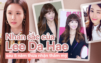 Sau 5 năm thừa nhận "dao kéo", nhan sắc Lee Da Hae khiến nhiều người không khỏi bất ngờ