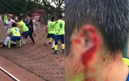 Xung đột trên sân, cầu thủ Trung Quốc cắn rách tai đối thủ