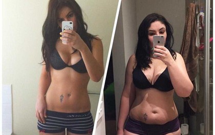 Đây không phải là hình trước và sau giảm cân, đây là câu chuyện của chiến thắng
