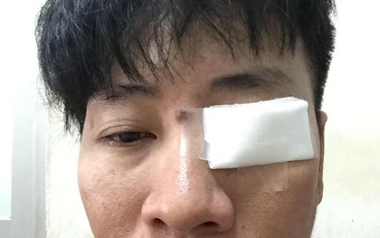 Tài xế đánh nam thanh niên xung phong toét mắt khi bị nhắc nhở vì đỗ xe gây tắc đường