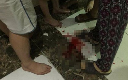Đang nô đùa, hai bé trai bị gạch ốp tường chung cư rơi vào đầu