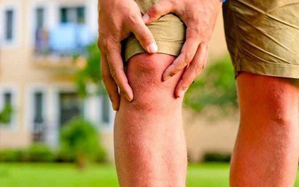 Một vài dấu hiệu cảnh báo đầu gối của bạn đang gặp những vấn đề không nhỏ