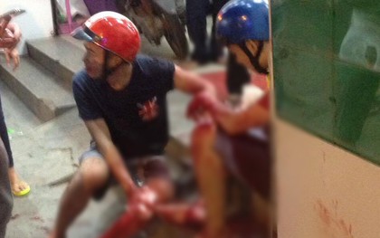 Truy đuổi kẻ cướp, 2 nam thanh niên bị đâm trọng thương trên phố Sài Gòn