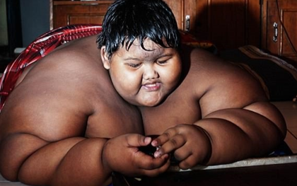 Hậu phẫu thuật thành công, cậu bé nặng nhất thế giới giảm gần nửa số cân, có cuộc sống bình thường