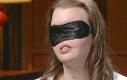 Mất nửa mặt vì tai nạn, giờ đây cô đã có một lý do tuyệt vời để tự tin tháo chiếc mặt nạ đã gắn liền hơn 11 năm trời