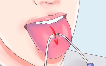 Mùi hôi miệng sẽ không còn là nỗi lo nếu bạn tuân thủ 5 nguyên tắc này tại nhà