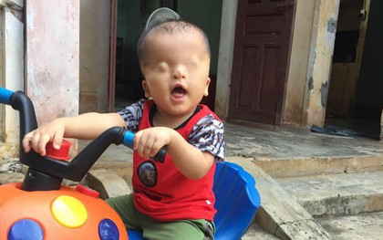 Cậu bé không có đôi mắt ở Nghệ An tuyệt vọng khi bác sĩ tại Singapore kết luận về cơ hội nhìn thấy ánh sáng