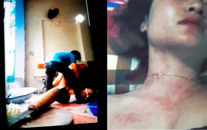 Tình tiết bất ngờ vụ vợ lên FB tố bị bạo hành: Người chồng khẳng định tất cả chỉ là chiêu trò của vợ