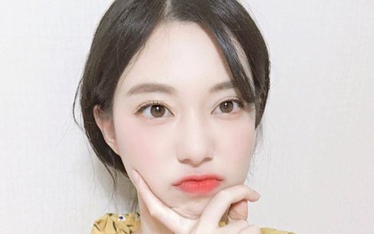 Chỉ vì 5 sai lầm giản đơn này mà công cuộc trị mụn của nhiều cô nàng đã thành “công cốc”