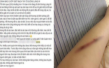 Cô gái tố bị rạch tay, cướp túi xách trên đường phố Hà Nội thế nhưng sự thật được hé lộ ngay sau khi Công an vào cuộc