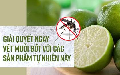 Giải quyết ngay vết muỗi đốt với các sản phẩm tự nhiên này