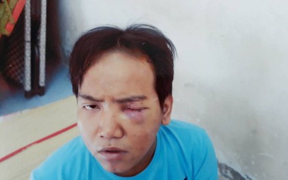 Đình chỉ điều tra vụ bảo vệ dân phố sát hại bé trai 6 tuổi ở Sài Gòn vì đối tượng bị tâm thần