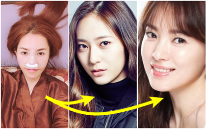 Từng mê Krystal nay lại đổi sang Song Hye Kyo, Quế Vân hễ thích ai là đi sửa mũi cho giống bằng được người ấy