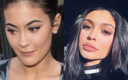 "Nữ hoàng môi tều" Kylie Jenner gây xôn xao vì đôi môi mỏng dính khó nhận ra sau khi rút filler