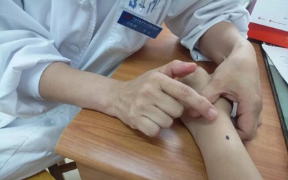 Cô gái 26 tuổi bị ung thư da sau khi làm việc này với nốt ruồi, bác sĩ cảnh báo những dấu hiệu ở nốt ruồi cần đi khám gấp