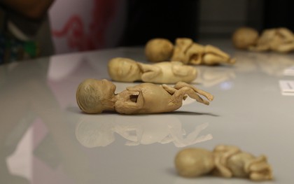 Tạm ngưng hoạt động triển lãm xác người thật ở Sài Gòn