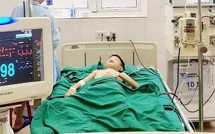 Nghệ An: Trèo lên nhà tắm, cháu bé 11 tuổi bị ong vò vẽ đốt hơn 100 nốt toàn thân