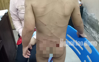 Giải cứu bé trai 3 tuổi bị cha dượng đánh dã man ở Phú Quốc