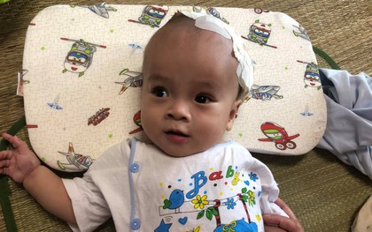 Tiếng khóc thương tâm của bé trai 10 tháng tuổi mắc bệnh não úng thủy ở Nghệ An