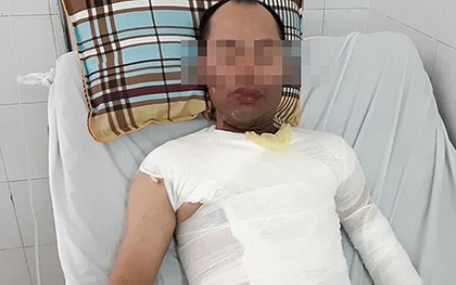 Vụ người đàn ông bị tạt axit ở Hà Đông: Con gái hoảng loạn vì chứng kiến bố bị tấn công
