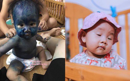 Cô bé 7 tháng tuổi được bà mẹ trẻ ra tay hóa trang như "người ngoài hành tinh" sau khi bị thủy đậu khiến nhiều người bật cười