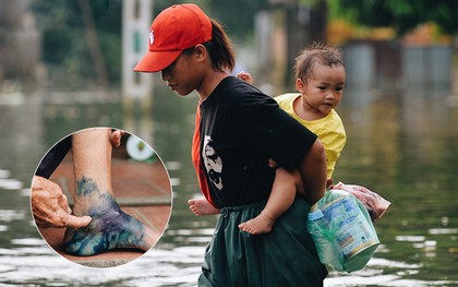 Người dân Chương Mỹ trong trận lụt lịch sử: Trẻ nhỏ chưa được đến trường, người già lở loét da sau nửa tháng ngâm mình trong nước