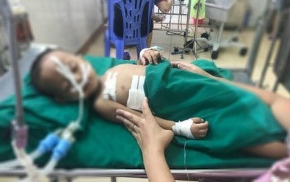 Nghịch súng hơi, bé trai 19 tháng tuổi ở Nghệ An bị đạn găm vào ngực