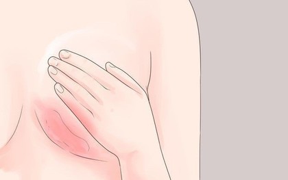 4 dấu hiệu ban đầu của nhiều căn bệnh nguy hiểm mà con gái không nên chủ quan bỏ qua