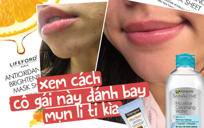 Cùng nghe cô nàng này mách nước đẩy lùi mụn li ti chỉ với chu trình dưỡng da cơ bản