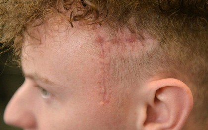 Ra tiệm cắt tóc bị cắt cho quả đầu xấu đau xấu đớn, nhưng không ngờ chính điều đó lại cứu sống chàng thanh niên này