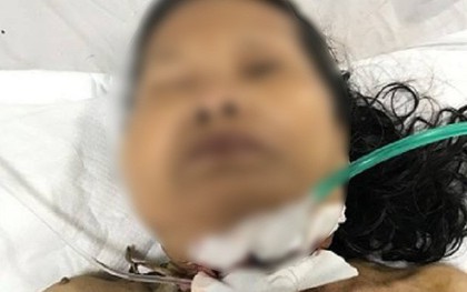 Cháu đang mổ gà, cụ bà trượt ngã trúng dao xuyên cổ