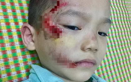 Mẹ trẻ tố y tá ngồi buôn điện thoại, bỏ mặc con trai bị thương vì không kịp mang tiền đóng viện phí