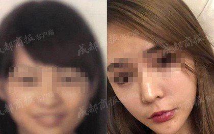 Gọt cằm quá đà từ nhiều năm trước, cô gái trẻ không được lên máy bay do bị hệ thống nhận diện sân bay từ chối