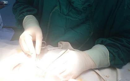 TP.HCM: Người đàn ông nhập viện vì tự cắt bao quy đầu