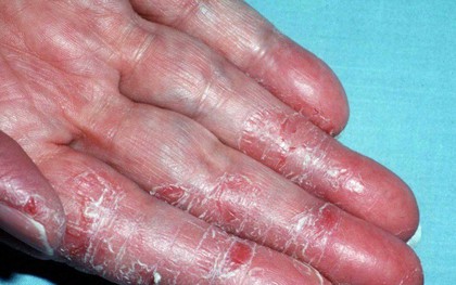 Hỏi khó: 500 triệu tế bào da đào thải mỗi ngày nhưng vì sao máu, chất dịch cơ thể không rò rỉ qua da?