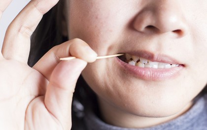 Đây là những lý do khiến bạn phải ngừng ngay thói quen sử dụng tăm để xỉa răng
