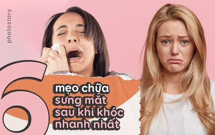 Mẹo giúp chữa sưng mắt nhanh nhất sau những lần "đổ lệ"