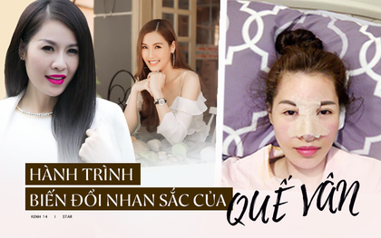 Hành trình "đại trùng tu" tiền tỷ của Quế Vân: Thay 24 bộ răng vẫn chưa ưng, làm mũi 6 lần vì mong được như Song Hye Kyo